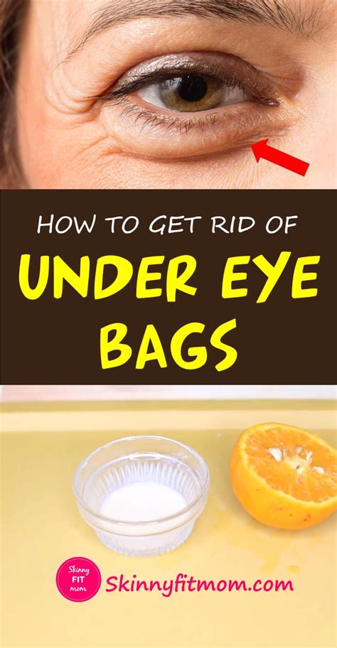 homemade under eye bag treatment